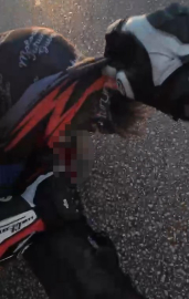 Motosikletiyle bariyere çarpmıştı, hayata 25 gün tutunabildi