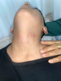 Küçükçekmece’de kadın memurun 10 yaşındaki öğrenciyi okulda darbettiği iddiası