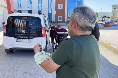 Sivas’ta acemi kasaplar hastanenin yolunu tuttu
