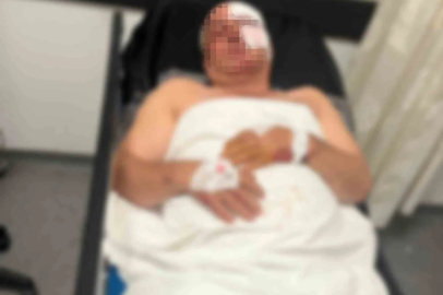 Motosiklet kazasında yaralandı, kardeşinin çarptığını iddia etti

