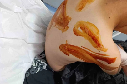 Şanlıurfa’da 11 yaşındaki çocuğa öldüresiye dayak
