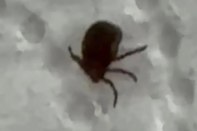 Kenenin ısırdığı vatandaş kontrol amacıyla hastaneye başvurdu
