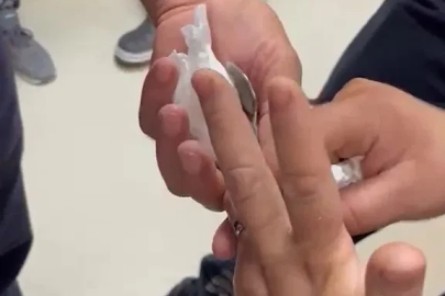 Yüzüğü parmağına sıkışan kadının yardımına itfaiye koştu
