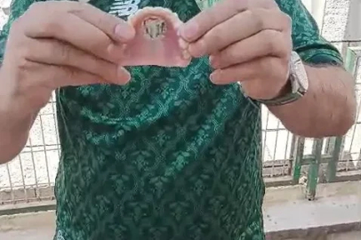 Bursaspor’un fanatik taraftarı takma dişinin damağına da kulüp amblemi yaptırdı