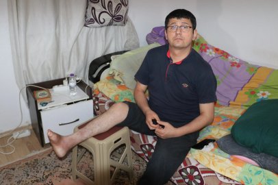 19 yıldır ayağındaki yaraya çare arıyor