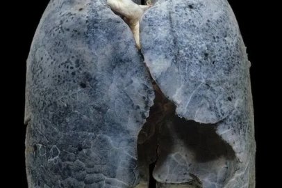 Bakan Memişoğlu'ndan 'tütün ürünü satışı' açıklaması