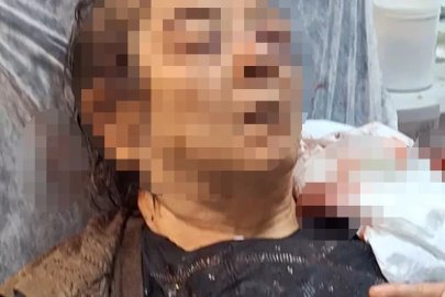 Tavandan başına sıva parçaları düşen kadının oğlu: Burnunda kırık, sol gözünde görme kaybı var
